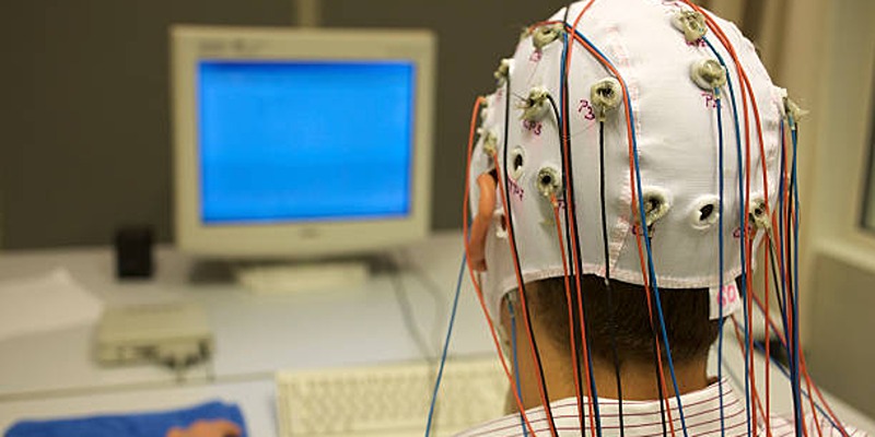 Understanding Epilepsy: Causes, Symptoms, and Treatment Options